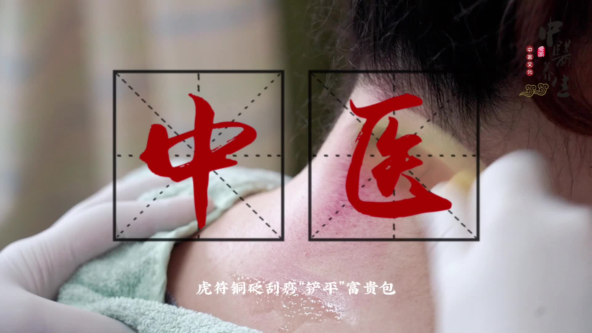 医点科普中医养生之虎符铜砭刮痧铲平富贵包